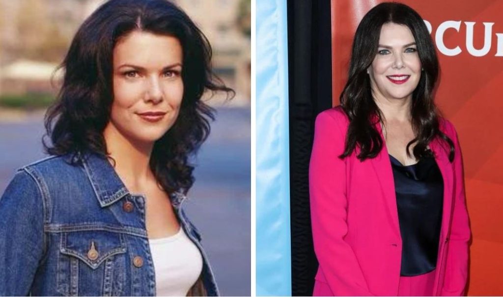 Lauren Graham Plastic Surgery: Has She Had Any Cosmetic Procedures?