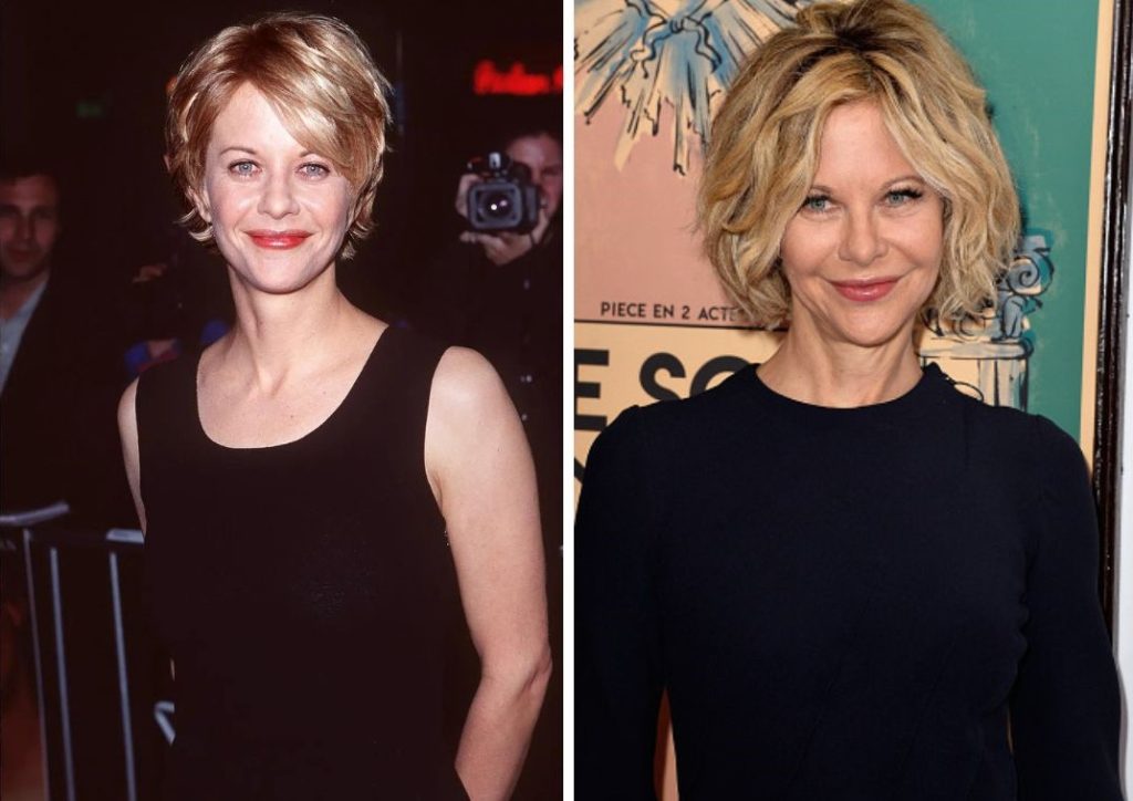 Meg Ryan Plastic Surgery: What are plastic surgeons saying about her plastic surgery?