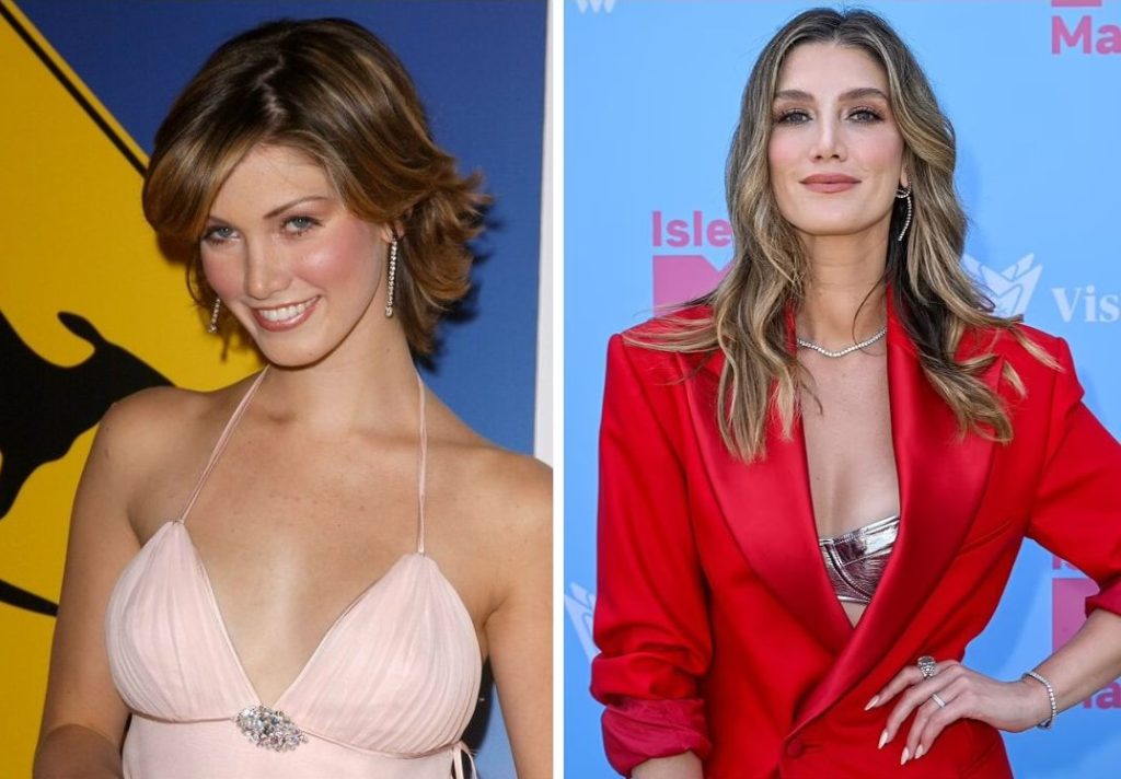 Delta Goodrem Plastic Surgery: Has She Undergone Plastic Surgery To Maintain Her Youthful Appearance?