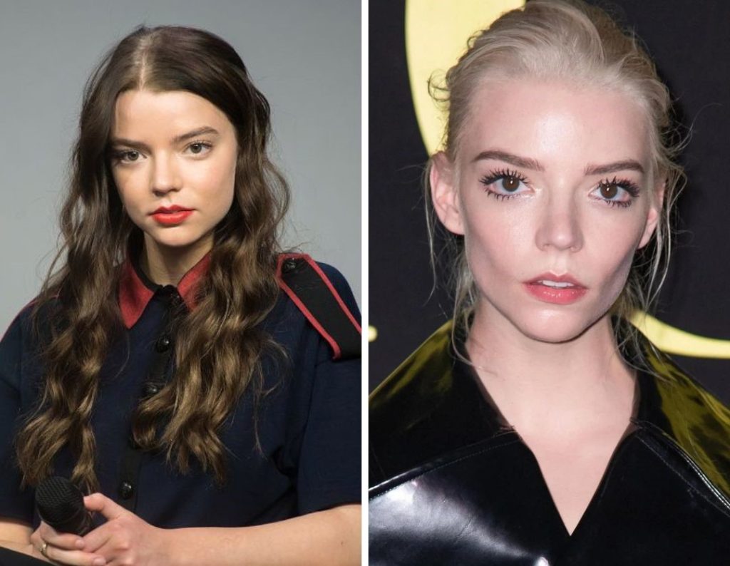 Anya Taylor-Joy Plastic Surgery: Did Fans Notice Her Facial Changes?