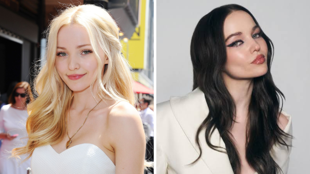 Dove Cameron Plastic Surgery