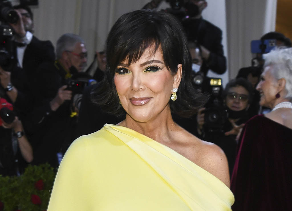 Kris Jenner Plastic Surgery